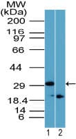 Polyclonal Rabbit anti-Mouse Rhox11 Antibody (aa139-152, IHC, WB)