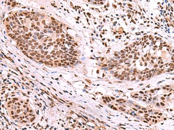 SF3B130 / SF3B3 Antibody