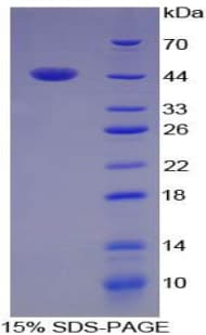 Mouse Angiogenin / ANG Protein (Recombinant His-GST)