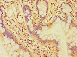 CASP6 / Caspase 6 Antibody (aa24-293)