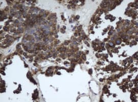 EPHX1 / Epoxide Hydrolase 1 Antibody (aa21-230, clone OTI4G4)