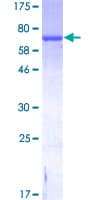 Human GFAP Protein (Recombinant GST)