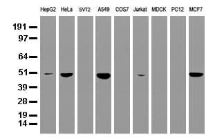 Monoclonal Mouse anti-Human SQSTM1 Antibody (clone UMAB12, Carrier-free, IHC, IF, WB)