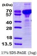 Human CRNN / Cornulin Protein (Recombinant His)