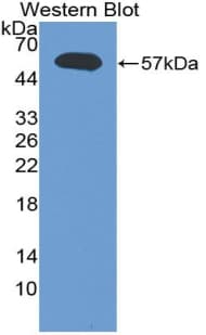 LTA / TNF Beta Antibody (aa35-191, Biotin)