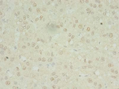 MRPL3 Antibody