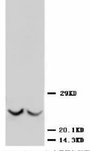 TIMP3 Antibody (C-Terminus)