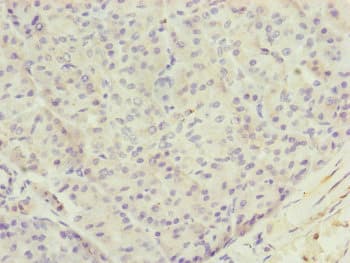Polyclonal Rabbit anti-Human TTLL7 Antibody (IHC, WB)