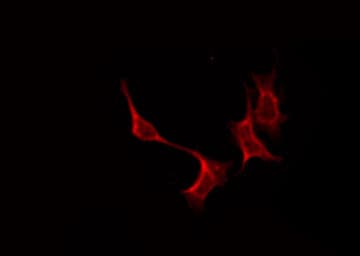 S1PR4 / SIP4 / EDG6 Antibody