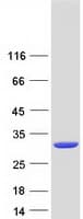 Human GSTA3 Protein (Recombinant Myc-DDK (Flag))