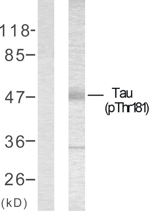 Polyclonal Rabbit anti-Human MAPT / Tau Antibody (phospho-Thr181, WB)