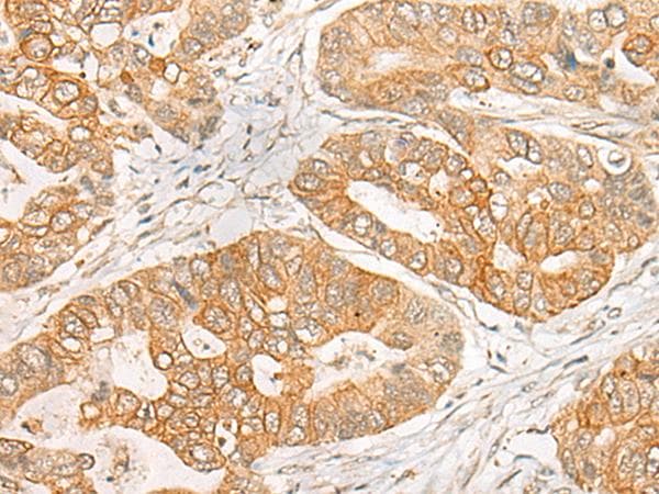 GNB1L / FKSG1 Antibody