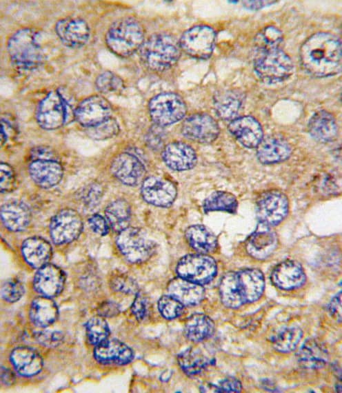 PFKFB4 Antibody (aa266-296)