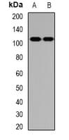 IHC-plus™ PNPLA3 / Adiponutrin Antibody