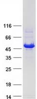 Human HSDL2 Protein (Recombinant Myc-DDK (Flag))
