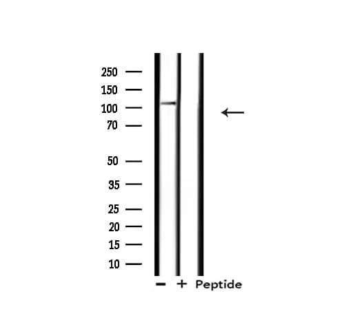 ERCC4 / XPF Antibody
