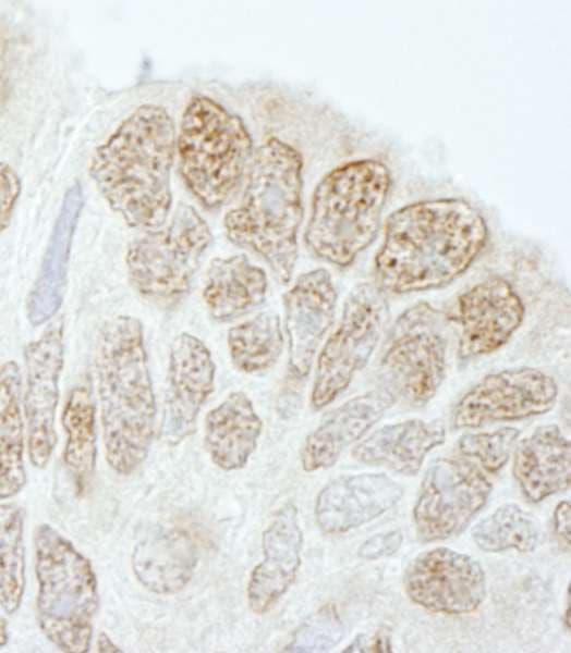 DROSHA / RNASEN Antibody (aa1050-1100)