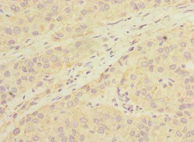 LHPP Antibody
