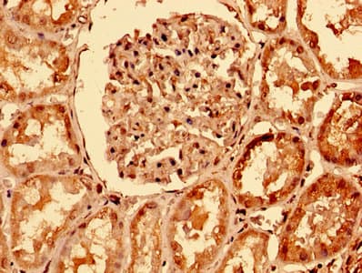 Polyclonal Rabbit anti-Human TNFRSF10A / DR4 Antibody (IHC, IF, WB)