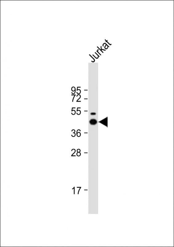 p56lck / LCK Antibody (clone 1526CT823.75.16)
