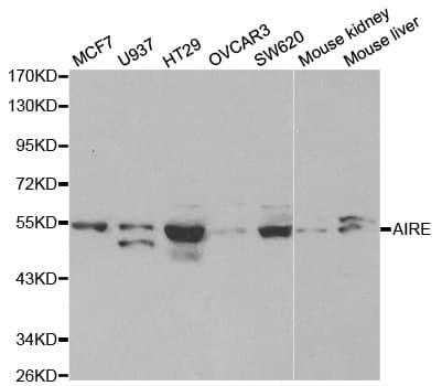 IHC-plus™ Polyclonal Rabbit anti-Human AIRE Antibody (IHC, IF, WB)