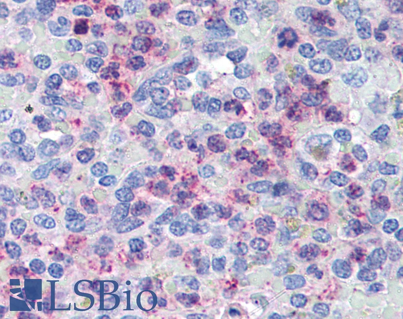 IHC-plus™ CXCR4 Antibody