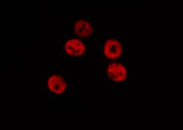STAT6 Antibody (phospho-Tyr641)