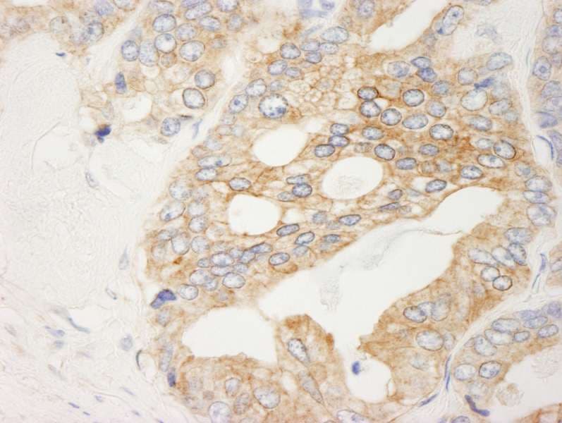 FLNB / TAP Antibody (aa2552-2602)