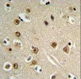 Polyclonal Rabbit anti-Human GABRA4 Antibody (aa350-377, IHC, WB)