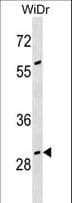 GAS2 Antibody (aa68-94)
