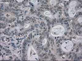 BUB1B / BubR1 Antibody (clone OTI11D7, Carrier-free)