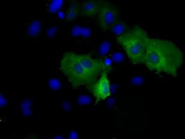 PSMC3 Antibody (clone OTI7D1)