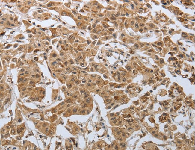 PSMD6 Antibody