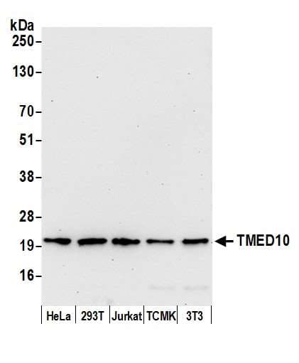 TMED10 / TMP21 Antibody (aa50-100)