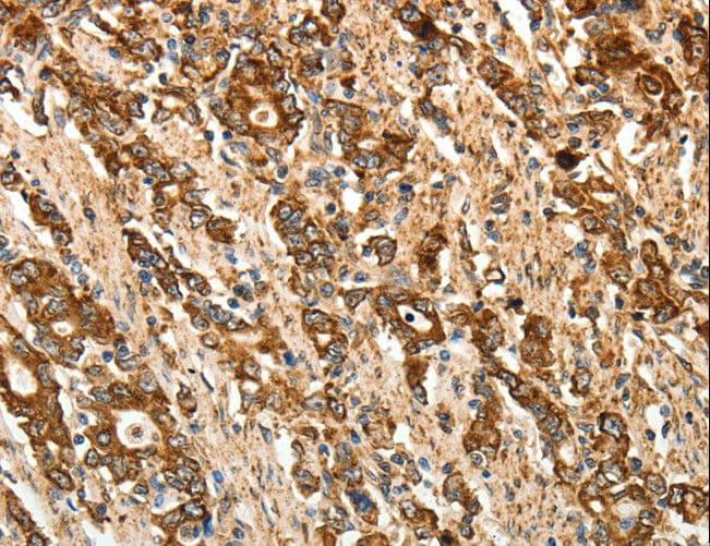 CALR / Calreticulin Antibody