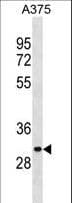 ARMCX6 Antibody (aa10-39)