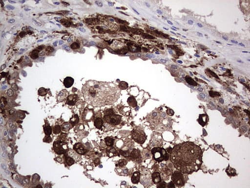 LGALS3 / Galectin 3 Antibody (clone OTI9C7)