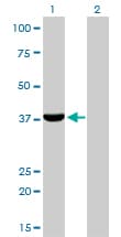IHC-plus™ AKR1C4 / Chlordecone Reductase Antibody (clone 2C11)