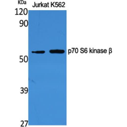 RPS6KB2 / S6K2 Antibody (360-440 aa)