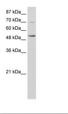 IKZF3 / AIOLOS Antibody (N-Terminus)