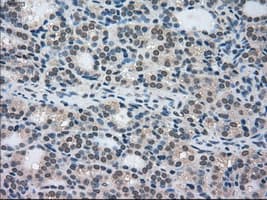 STK39 / SPAK Antibody (clone OTI4E3)