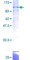 Human ZBTB43 Protein (Recombinant GST)