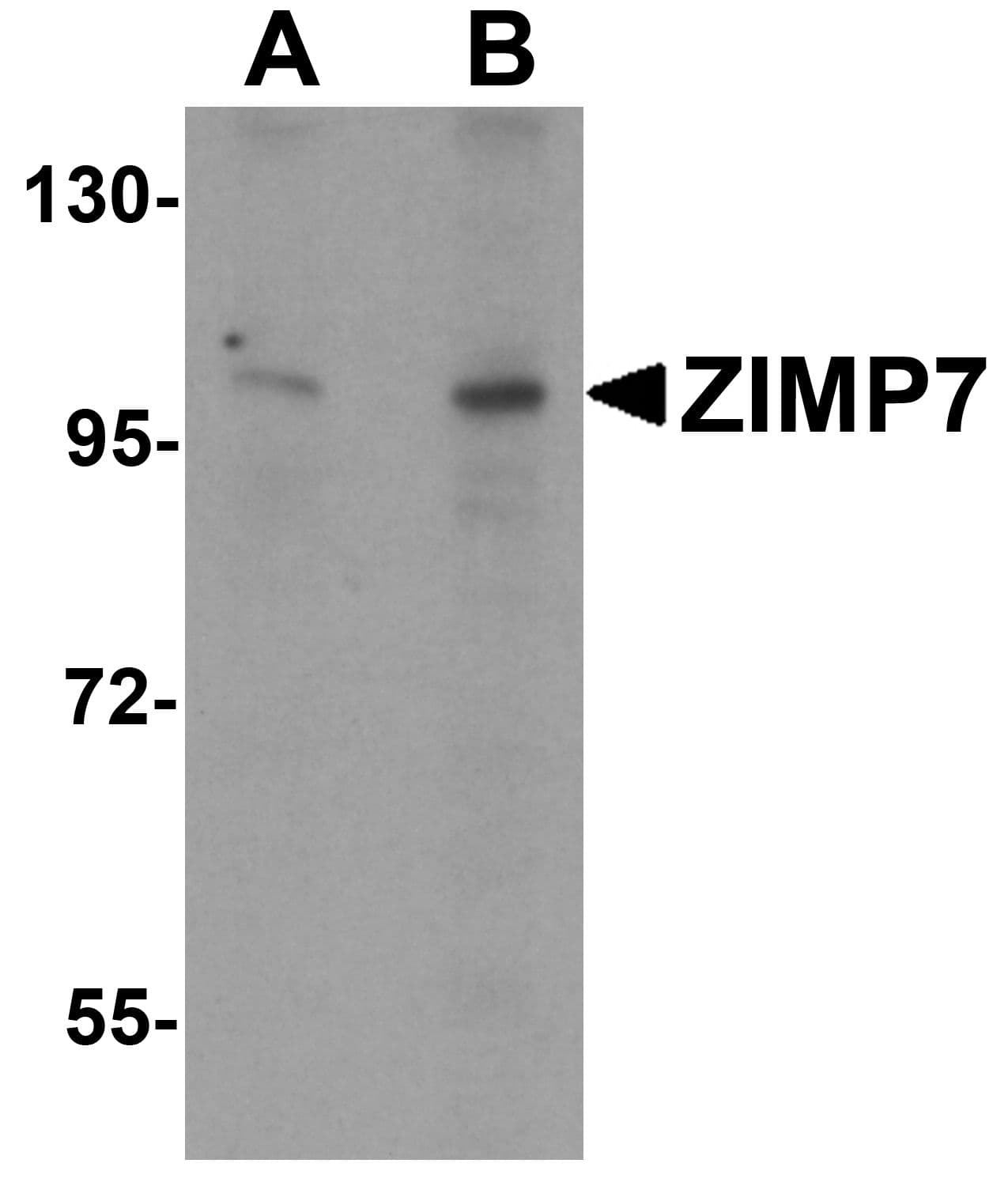 Polyclonal Rabbit anti-Human ZIMP7 / ZMIZ2 Antibody (WB)