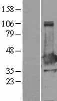 NHEJ1 / XLF Protein (Over-Expression Lysate Myc-DDK (Flag))