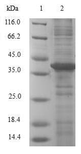 Human LGMN / Legumain Protein (Recombinant 6His, N-terminus)