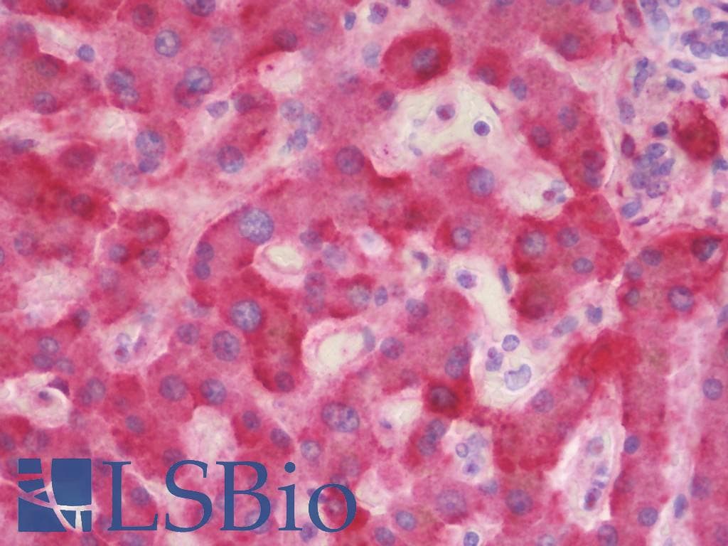 IHC-plus™ C4BPA / C4BP Alpha Antibody (aa470-499)