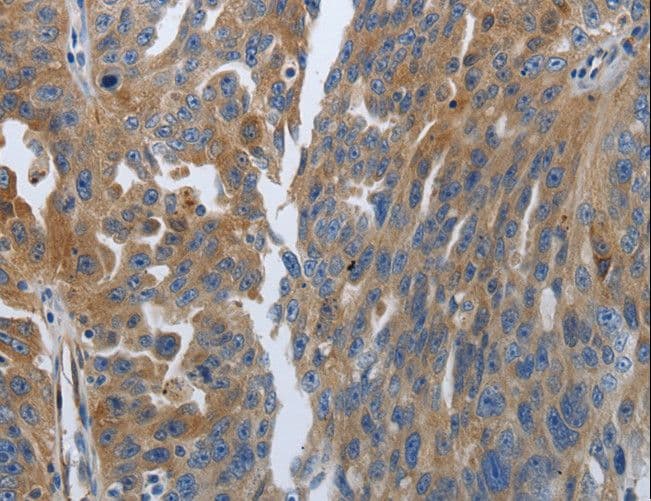 SOCS1 Antibody