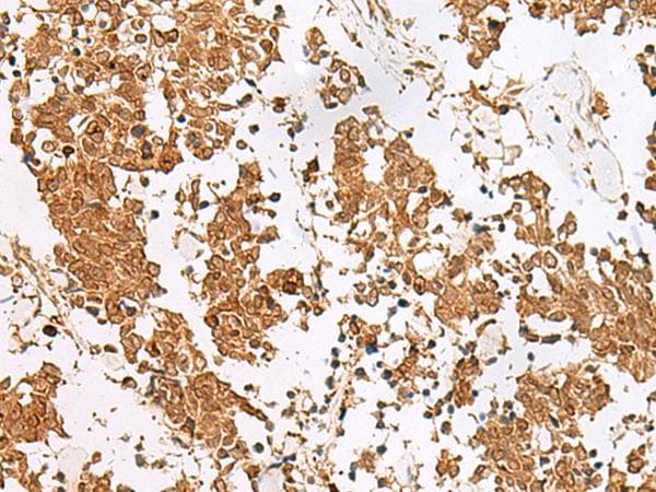 Polyclonal Rabbit anti-Human SCRN2 / Ses2 Antibody (IHC, WB)