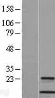 Human CSTA / Cystatin A Protein (Over-Expression Lysate Myc-DDK (Flag))