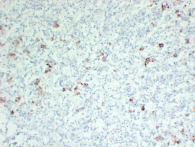 TSHB / TSH-Beta Antibody (clone ABT-TSH)